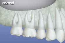 sinus1